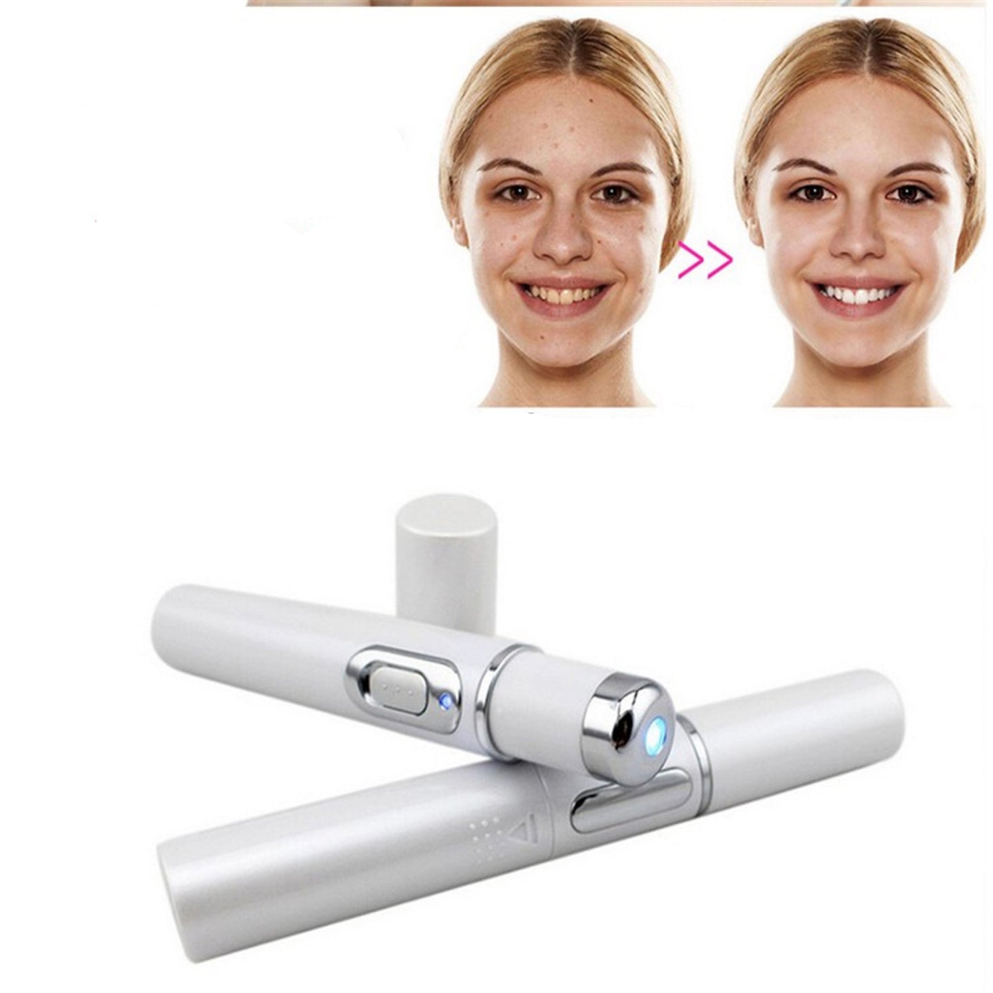 Wrinkle Blemish Pore Acne Scar Remover Pen